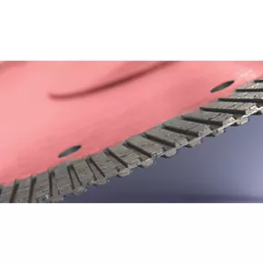 Marcrist BF650SF Multi-Material Turbo Diamond Blade 230 x 22.2mm 4 Marcrist BF650SF Multi-Material Turbo Diamond Blade 230 x 22.2mm - Image 2